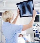 Depistarea precoce a cancerului pulmonar, tema de dezbatere intre medicii specialisti