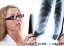 Tuberculoza multirezistenta consuma anual miliarde de euro
