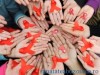 50 de spitale monitorizeaza HIV/SIDA si alte 85, Tuberculoza