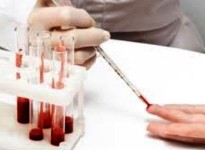 Un simplu test de sange poate depista prenatal sindromul Down