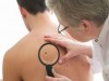 Cancerul de piele ar putea fi recunoscut ca boala profesionala