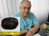 EXCLUSIV: Chirurgul buzoian Marius Anastasiu bifeaza o noua premiera medicala