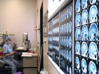 Neurochirurgii romani au finalizat cel mai amplu studiu din ultimul deceniu