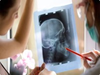 Peste 60.000 de români suferă anual traumatisme cranio-cerebrale
