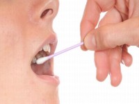 Cancerul oral si cel pancreatic, depistate in urma unui simplu test de saliva