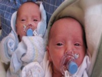 Gemene nascute la diferenta de 51 de zile, la spitalul Cantacuzino