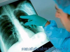 „Asuma-ti sa fii sanatos!” Factori de risc mai putin cunoscuti in patologia pulmonara