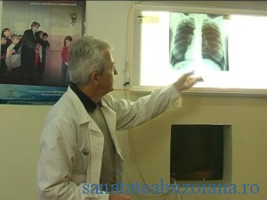 Trei sferturi din pacienții români cu cancer pulmonar ajung la medic prea târziu