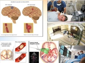 Recuperarea dupa accidentul vascular cerebral adusa in atentia autoritatilor