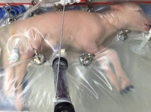 Un „uter artificial” ar putea revolutiona neonatologia