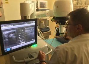 O noua terapie cu ultrasunete pentru tumori benigne