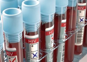 Ministerul Sănătății elaborează strategii pentru bolnavii de HIV/SIDA