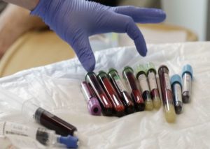 Test de sânge pentru evaluarea riscului de Alzheimer