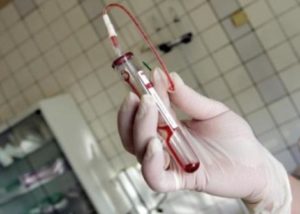 Test de sânge pentru depistarea precoce a cancerului