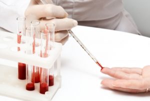 Chimioterapia inutilă, evitată cu ajutorul unui test de sânge