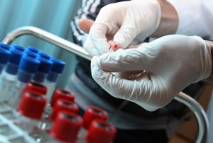 Un nou test de sânge are capacitatea de a detecta riscul a peste 50 de tipuri de cancer