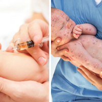 Vaccinare vs nevaccinare