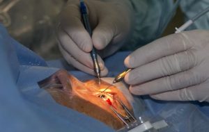 A scăzut numărul transplanturilor de cornee efectuate la Spitalul Militar Central