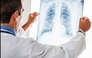 Apel către pacienți pentru diagnosticarea timpurie a hipertensiunii arteriale pulmonare