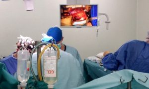 Rinichii produși în laborator – posibilă alternativă pentru transplantul de organe