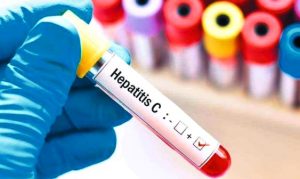 Asociația Română Anti-SIDA se implică în combaterea hepatitei C