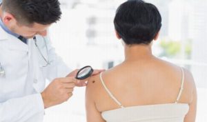Riscul apariției cancerelor de piele revine în actualitate