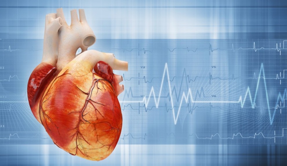 inima tahicardie – infarct1