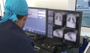 Prima platformă de second opinion din România destinată pacienților cu boli interstițiale pulmonare