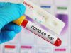 Peste 60 de medici de familie buzoieni testează gratuit infecția cu SARS-CoV-2