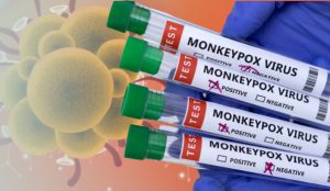 A fost confirmat primul caz de „variola maimuței” în România