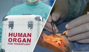 Percheziții la o clinică din București, acuzată că a importat ilegal organe și țesuturi pentru transplant