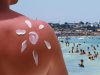 Melanomul, diagnosticul „care arde” în sezonul estival – campanie de prevenție, pe litoral