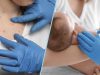 Peste 35.000 de români, atinși de rujeolă în ultimii doi ani și jumătate